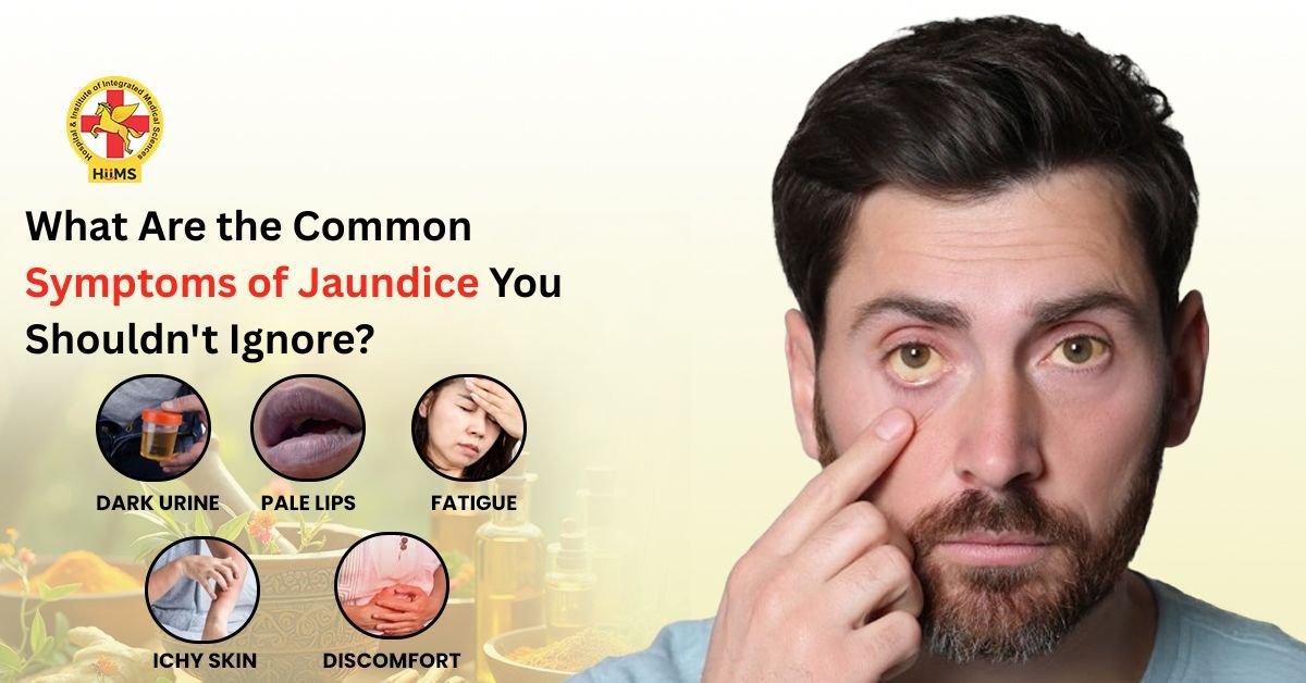 What Are the Common Symptoms of Jaundice You Shouldn't Ignore?